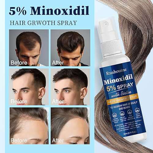 5% Minoxidil Hair Growth Spray Serum, Hair Regrowth Treatment for Men and Women, Strengthens and Thickens Hair for Fuller, Longer Results, Beard and Facial Hair Enhancer - Image 4