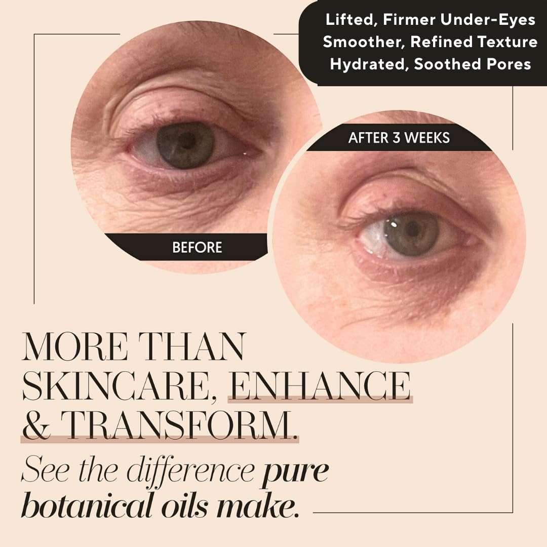 100% Organic Tsubaki Face Oil & Under-Eye Serum. Jojoba, Calendula, & Rice Bran - Hydrating & Brightening for Glowing Skin, Dark Spots & Even Skin Tone, Moisturizing Anti Aging Serum by Finally - Image 8