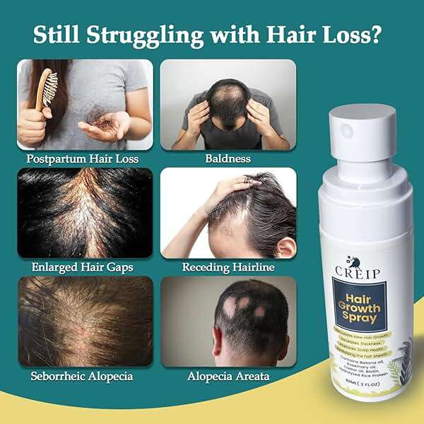 Natural Hair Growth Oil Spray: Natural Formula with Batana, Castor and Rosemary Oil, Rice Water, and Biotin for Women and Men - Image 3