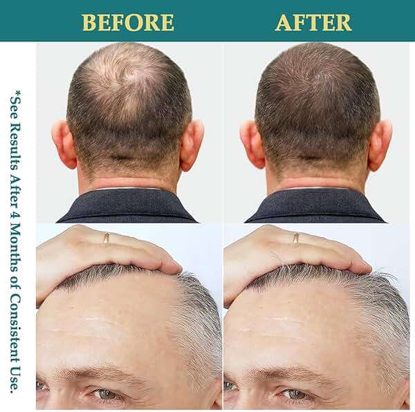 Natural Hair Growth Oil Spray: Natural Formula with Batana, Castor and Rosemary Oil, Rice Water, and Biotin for Women and Men - Image 4