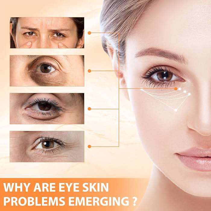 Tbexem Revive Glow Vitamin C Eye Balm, Hydrating Eye Cream,Improve Dark Circles,Brightens Skin Tone,Reduces Puffiness(2PCS) - Image 2