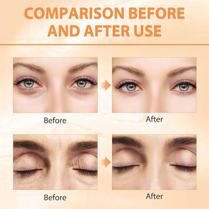 Tbexem Revive Glow Vitamin C Eye Balm, Hydrating Eye Cream,Improve Dark Circles,Brightens Skin Tone,Reduces Puffiness(2PCS) - Image 4