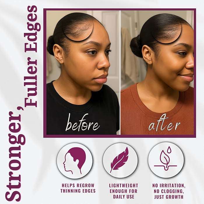 LIV Authentic Dr. Sebi Batana Oil for Hair Growth, 100% Pure Raw & Unrefined from Honduras, Aceite de Batana Hair Growth Oil for 4C Hair - Edges, Scalp, Length - Image 7