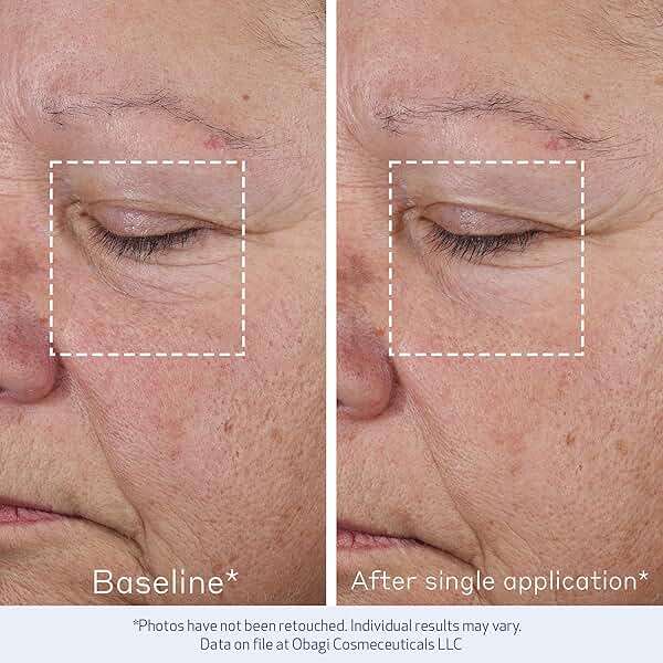 Obagi ELASTIderm Advanced Filler Concentrate – Clinically Proven Non-Injectable Filler with Biomimetic Peptide Technology that Firms Skin & Reduces the Appearance of Fine Lines & Wrinkles - Image 3