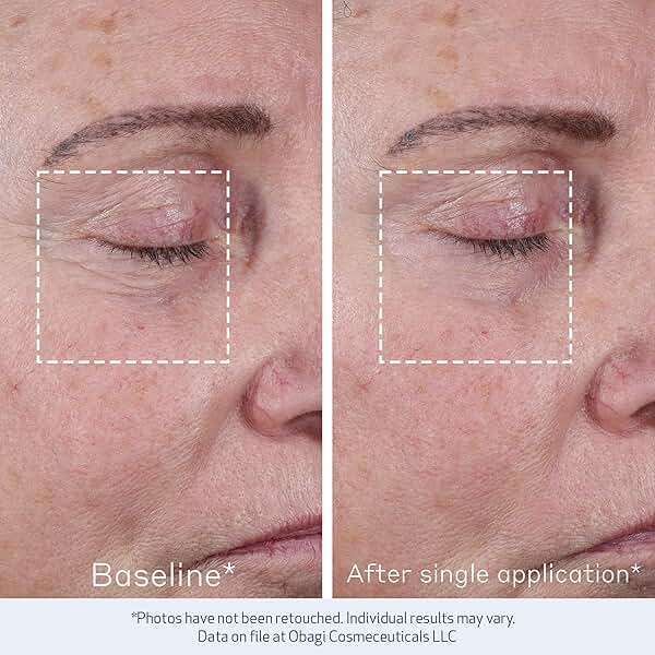 Obagi ELASTIderm Advanced Filler Concentrate – Clinically Proven Non-Injectable Filler with Biomimetic Peptide Technology that Firms Skin & Reduces the Appearance of Fine Lines & Wrinkles - Image 4