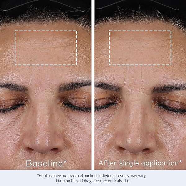Obagi ELASTIderm Advanced Filler Concentrate – Clinically Proven Non-Injectable Filler with Biomimetic Peptide Technology that Firms Skin & Reduces the Appearance of Fine Lines & Wrinkles - Image 5