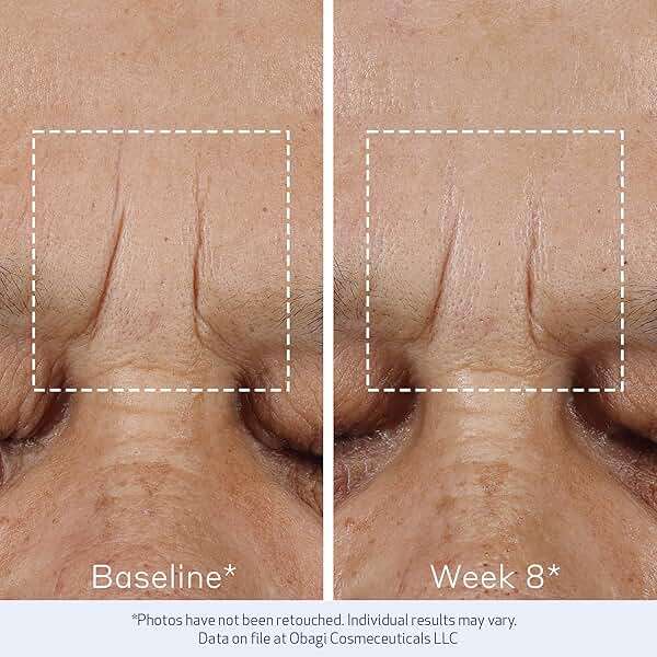 Obagi ELASTIderm Advanced Filler Concentrate – Clinically Proven Non-Injectable Filler with Biomimetic Peptide Technology that Firms Skin & Reduces the Appearance of Fine Lines & Wrinkles - Image 6