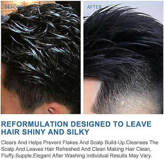 Ceson&Cesun Anti-Fungal/Anti Dandruff 2 in 1 Shampoo for Folliculitis, Scalp Psoriasis & Seborrheic Dermatitis, Itchy & Dry Scalp Relief, Nourishes, Hydrates, Fresh Scent, Safe For Color-Treated Hair - Image 5
