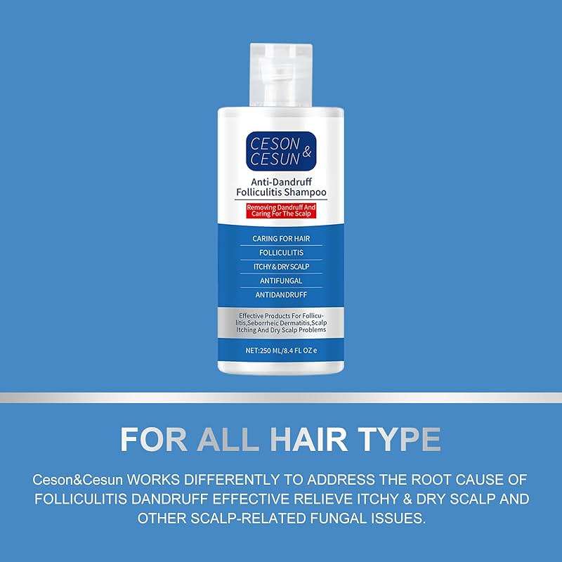 Ceson&Cesun Anti-Fungal/Anti Dandruff 2 in 1 Shampoo for Folliculitis, Scalp Psoriasis & Seborrheic Dermatitis, Itchy & Dry Scalp Relief, Nourishes, Hydrates, Fresh Scent, Safe For Color-Treated Hair - Image 8