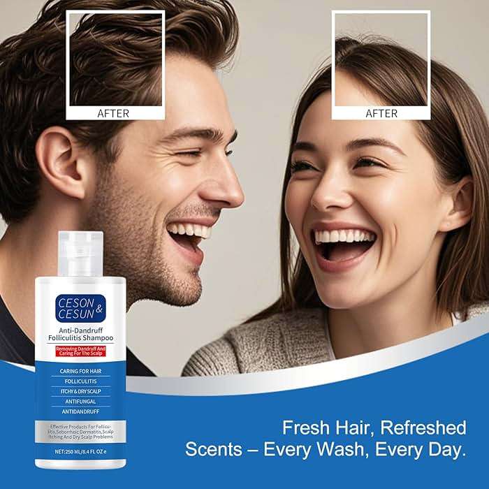 Ceson&Cesun Anti-Fungal/Anti Dandruff 2 in 1 Shampoo for Folliculitis, Scalp Psoriasis & Seborrheic Dermatitis, Itchy & Dry Scalp Relief, Nourishes, Hydrates, Fresh Scent, Safe For Color-Treated Hair - Image 10