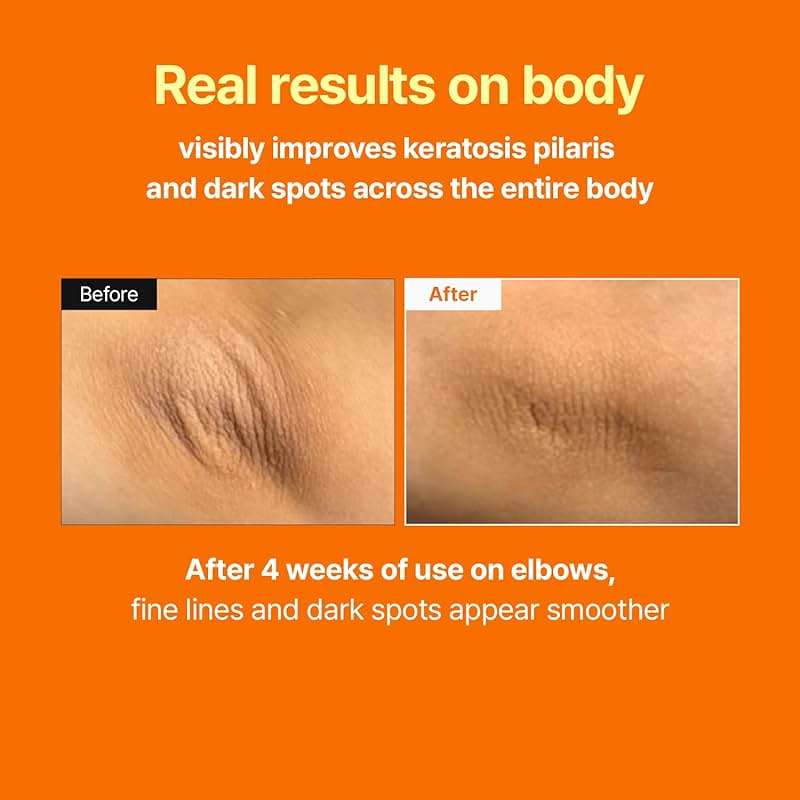 MEDITHERAPY Retinal Skin Booster Serum | Retinaldehyde, Niacinamide Anti-Aging Serum - K-Beauty Facial Serum for Fine Lines, Firming & Radiance | Hydrating Face Serum All Skin Types, 5.07 fl oz - Image 4