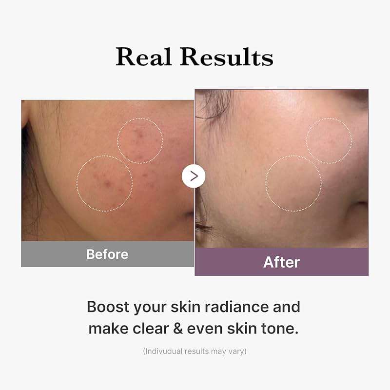 medicube Age-R Glutathione Glow Milky Toner, Low-Irritation Double Layer Toner for Glass Glow Skin with Peptide, Even Skin Tone, Radiance, Hydration, Korean Skincare - Image 5