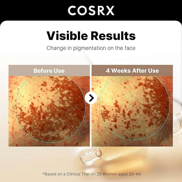 COSRX 2% Alpha Arbutin Discoloration Care Face Serum with Niacinamide, Glutathione & Tranexamic Acid, Serum to Target Dark Spots and Hyperpigmentation, Daily Korean Skin Care, 1.7 fl oz - Image 4