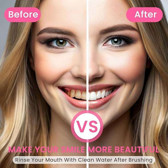 Niacinamide Toothpaste,Niacinamide Intensive Toothpaste,Fresh Breath Toothpastes, Remove Tooth Stains (3.8oz) - Image 5