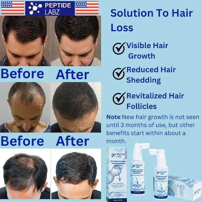 Peptide Hair Growth Serum Spray with Acetyl Tetrapeptide-3, Biotinoyl Tripeptide-1, Caffeine and Licorice Root Extract - Image 7