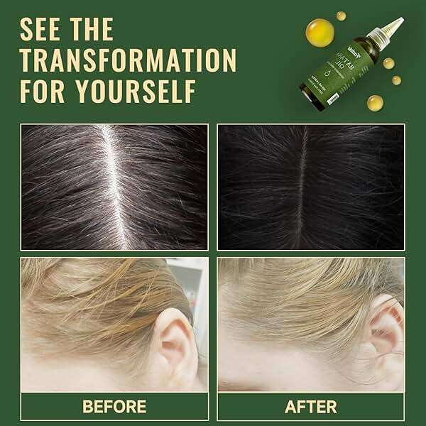 Fadelo Batana Oil - Dr Sebi Organic Oil for Hair Growth, 100% Raw Pure Natural from Honduras, Deeply Nourishing Scalp for Thicker & Stronger Hair, 4.05 fl oz - Image 2