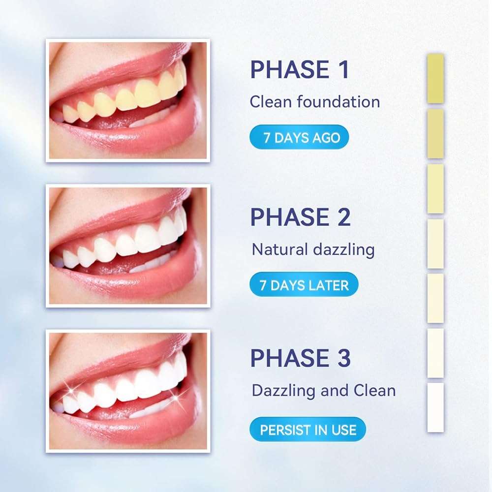 Somall Teeth Whitening Kit - Professional Tooth Whitening Gel LED Light System, 35% Carbamide Peroxide, 3ml Gel Syringes(3), Remineralization Desensitizing Gel(1), and teeth whitening light - Image 4