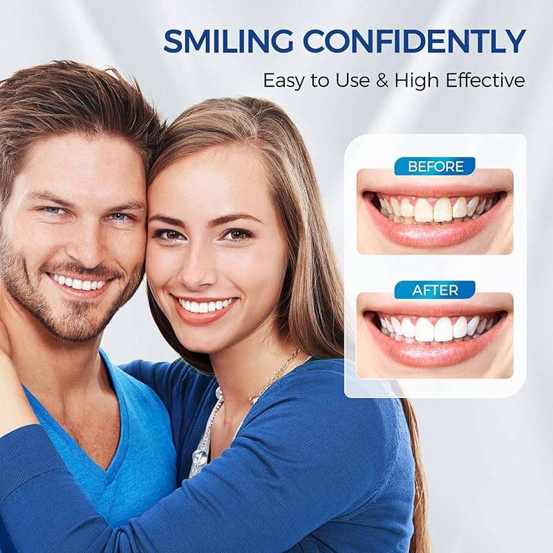 Teeth Whitening Kit for Sensitive Teeth,with 4 x 35% CP Pen & 1 Remineralization Pen,LED Accelerator Light Non,Tooth Whitener Professional Oral Care Gently Yet Effectively Removes Stains - Image 7