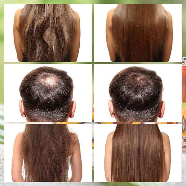 YIVANNUO Natural Hair Growth Cream, Organic and Natural Ingredients - Image 3