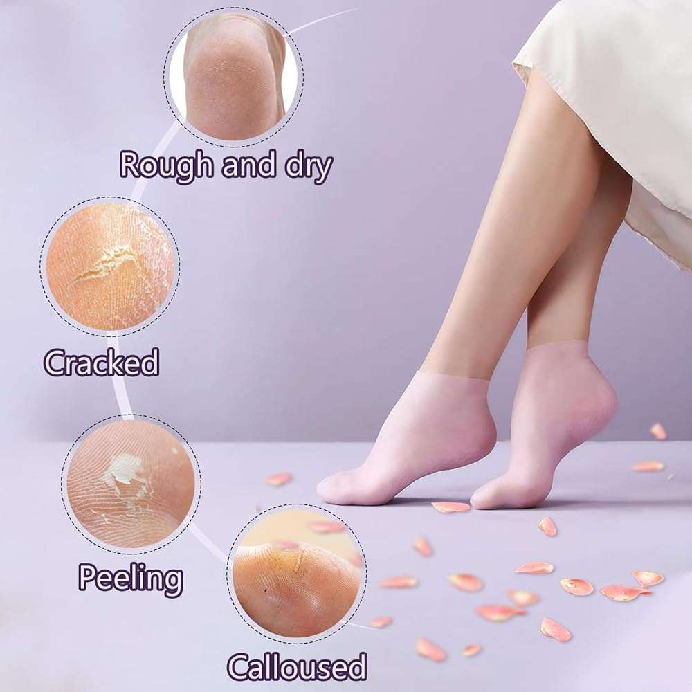 TEAWOO 5 Pairs Silicone Socks for Dry Cracked Feet, Women's Foot Socks for Moisturizing, Cracked Heel Treatment (5 Colors Assorted, Fits Up to Size 7) - Image 2