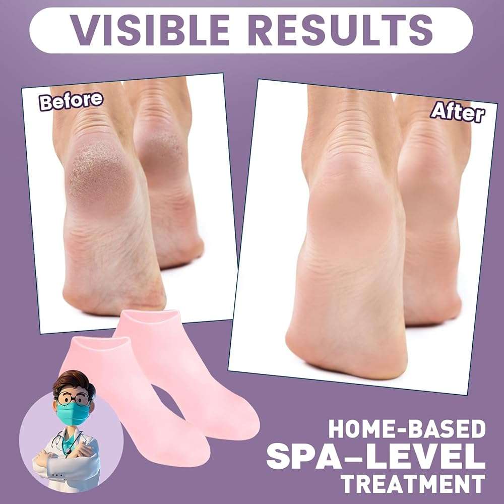 TEAWOO 5 Pairs Silicone Socks for Dry Cracked Feet, Women's Foot Socks for Moisturizing, Cracked Heel Treatment (5 Colors Assorted, Fits Up to Size 7) - Image 3