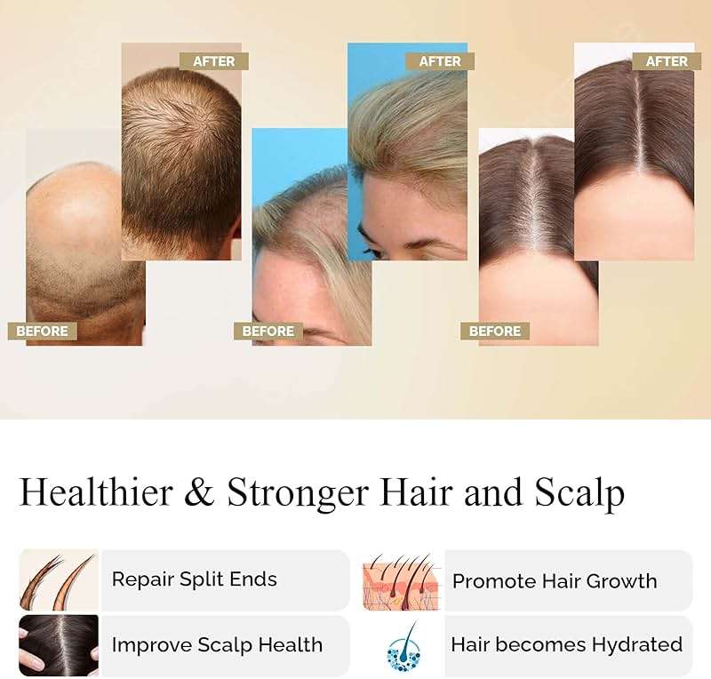 Organic Batana Oil for Hair Growth From Honduras | 100% Raw,Unrefined, Pure | Dr Sebi Scalp Care Hair Shine for Men & Women | Elaeis Oleifera Kernel | Natural Cold Press Extraction 5.3Fl oz - Image 3