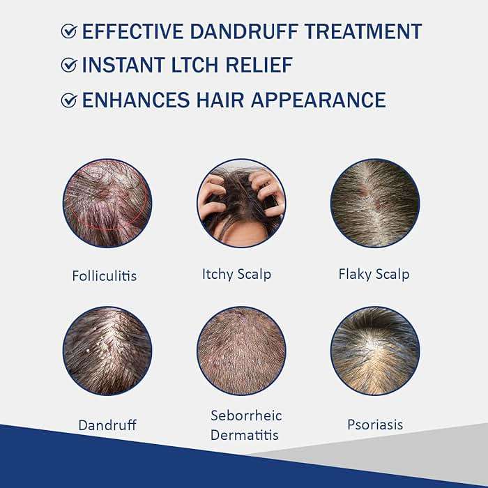 Danliss Sulfate Free - Anti Fungal Folliculitis Treatment Shampoo With Formula for Prone to Folliculitis,Seborrheic Dermatitis,For Normal to Oily Scalp Relieves Itchy & Dry Scalp, Dandruff - 10.1 Oz - Image 3