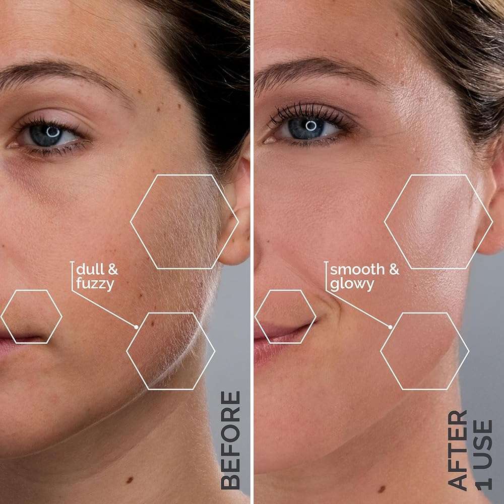 SPA SCIENCES - SIMA Patented Dermaplane Razor for Women Face – Painless 2-in-1 Facial Exfoliation & Peach Fuzz Hair Removal – Anti-Aging – 3 Speeds – Rechargeable – 19 Weeks Treatment - Image 4