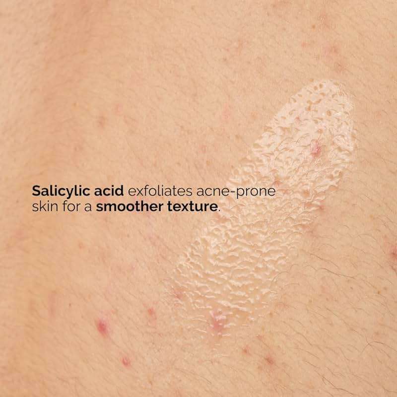 The Ordinary Salicylic Acid 0.5% Body Serum, Exfoliating Treatment for Acne-Prone Skin, 8.1 Fl Oz - Image 4