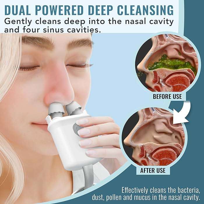 NASALFRESH MD Premium Bundle–Dual Powered Nasal Irrigation System Nasal Rinse and Wash, Sinus Decongestant Relief System, 60 Saline Packets, Case, Rechargeable, 2 Sets of Nose Pillows–Snoring Remedy - Image 5