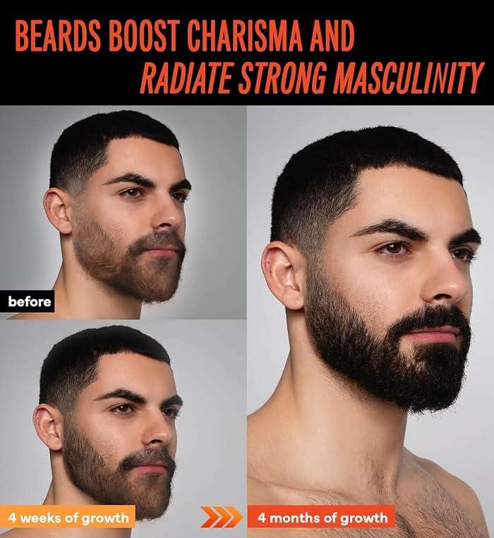 5% Minoxidil Beard Growth Oil for Men: Minoxidil for Men Beard Hair Regrowth Serum with Biotin and Caffeine - Unleash Your Wildness with Stronger Thicker Fuller Beard 2 FL OZ/60mL - Image 4