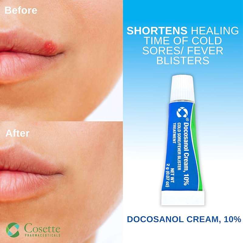 Cosette Cold Sore/Fever Blister Treatment for Face or Lips with Docosanol Cream, 10% - Treatment Cream for Cold Sore/Fever Blister (0.07 Tube) (1) - Image 2