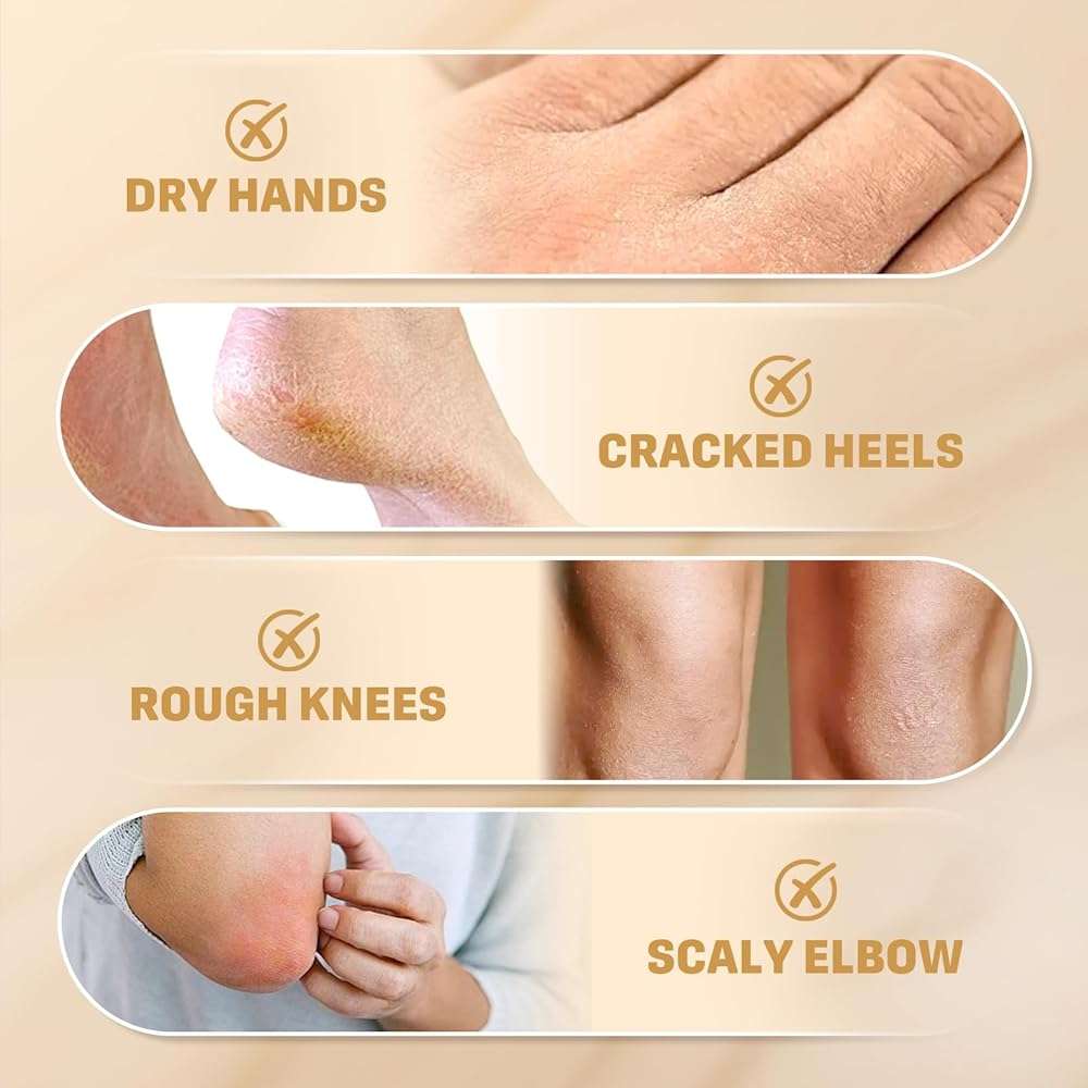 Clyecfra 60% Urea Cream with 2% Salicylic Acid, Urea Cream 60 Percent for Feet & Hands- Maximum Strength Moisturizer for Rough, Dry, Thick & Cracked Skin, Callus Remover, Deep Hydration, 150g - Image 6