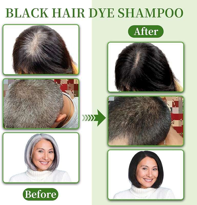 SHIHUANUO Black Hair Dye Shampoo 3 in 1 for Gray Hair Coverage, Herbal Ingredients Natural Shampoo Black Hair Dye for Women & Men/Ammonia-Free 520ml - Image 3