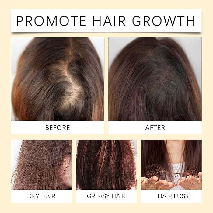 Batana Oil for Hair Growth, 4-In-1 Liquid Batana Oil with Rosemary, Castor, and Pumpkin Seed - 100mL/3.38 fl.oz (1) - Image 5
