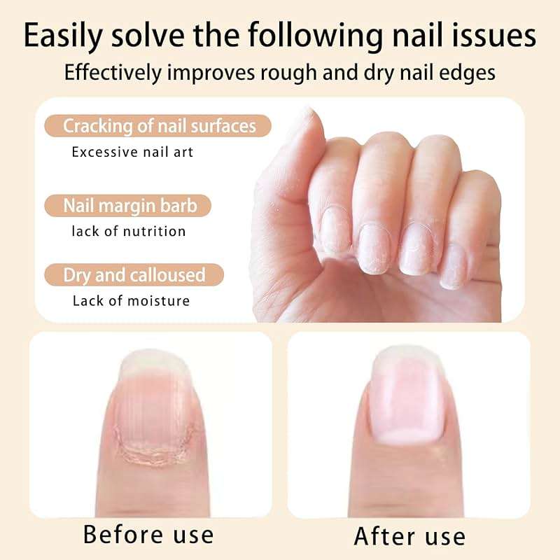 AOBOO Cuticle Oil Pen for Nails Care,Nail Oil For Strength,Nourish Moisten Care Nail Cream To Reduce Nail Cracking and Dry for Weak Peeling Brittle and Thin Nails - Image 5