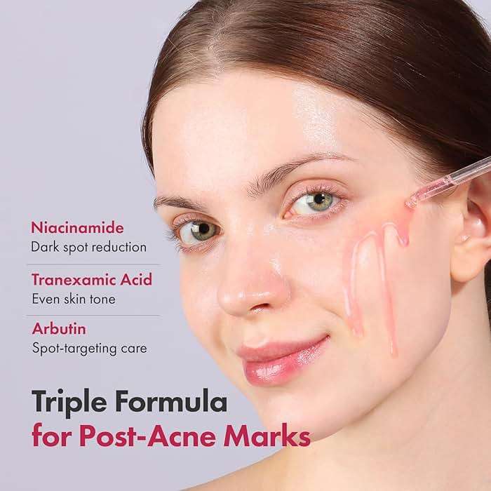 TOSOWOONG Niacinamide 10% + Tranexamic Acid 4% Serum, Arbutin 2%, Hyaluronic Acid, TXA Facial Serum, Glass Skin, Clarifying, Radiant Complexion with Natural Color, Korean Skin care, 33ml, 1.11 fl.oz. - Image 2