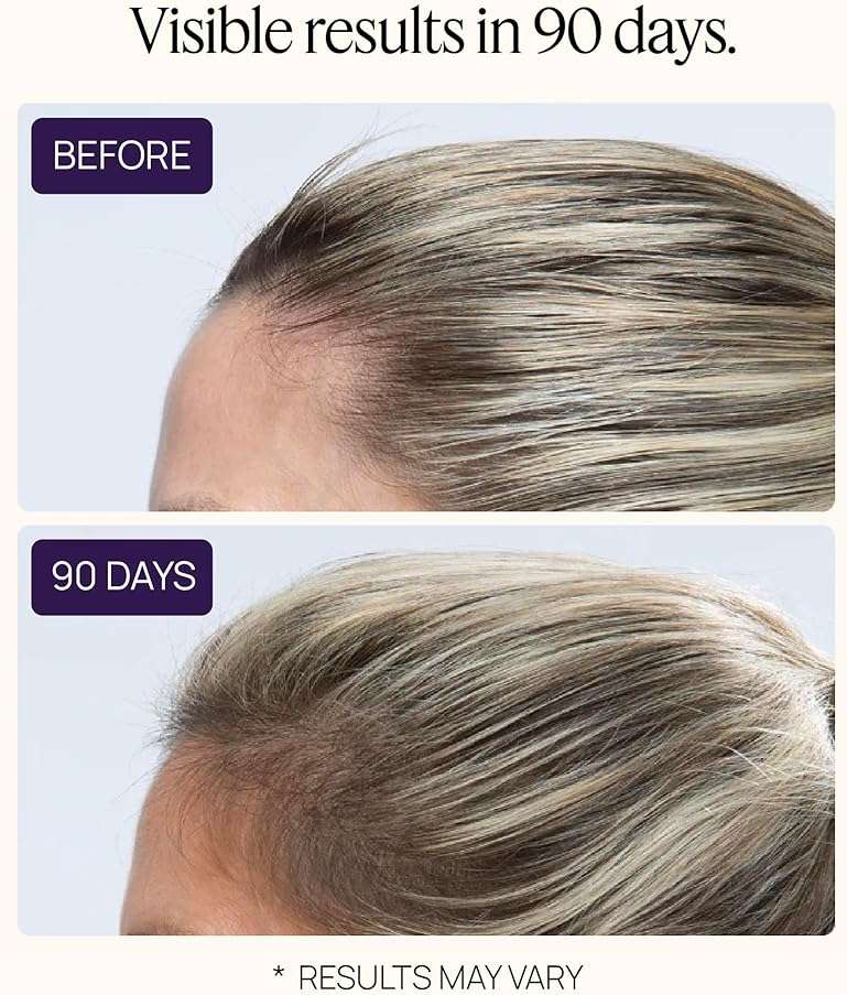Women's Hair Growth Peptides, Doctor Recommended, Follicle Fortifying Biotechnology, Clinically Shown to Reduce Hair Loss - Image 6