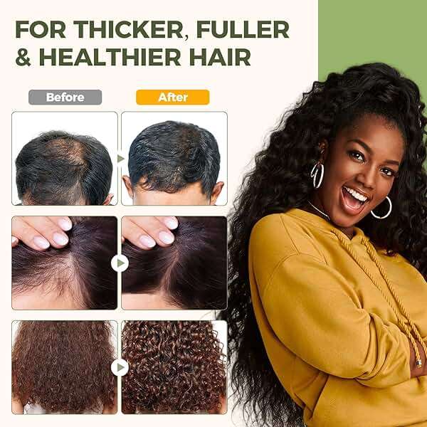Mixgee Batana Oil Balm for Hair Growth & Thickness, Natural Formula With Batana & Rosemary Oil & Biotin, Promotes Scalp Health for Thicker, Fuller Hair(4.23 OZ) - Image 3