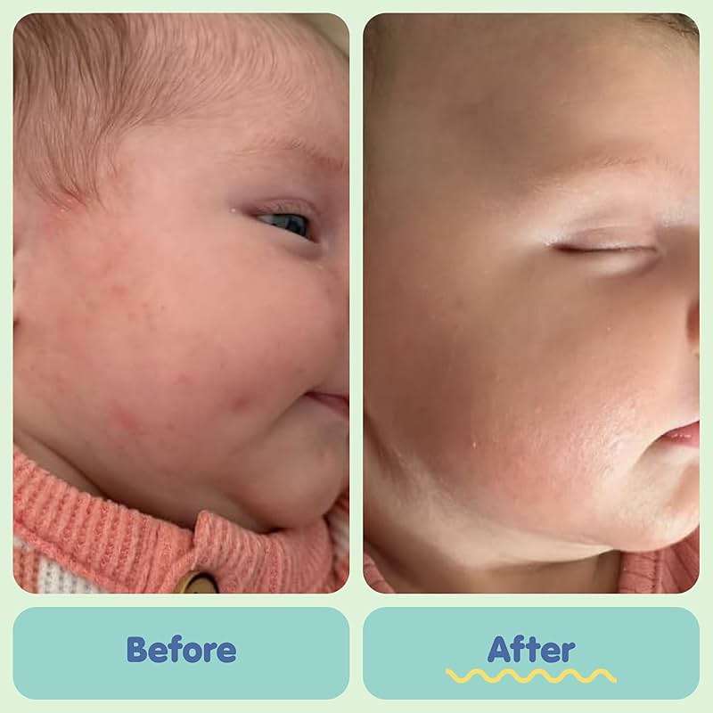 TUBBY TODD All Over Ointment - Baby Eczema Cream, Everyday Multi-Purpose Sensitive, Dry, Irritation Baby Skin Relief Cream, Steroid & Gluten Free, Fragrance Free, 3.5 oz & 8oz, 2 Pack - Image 5