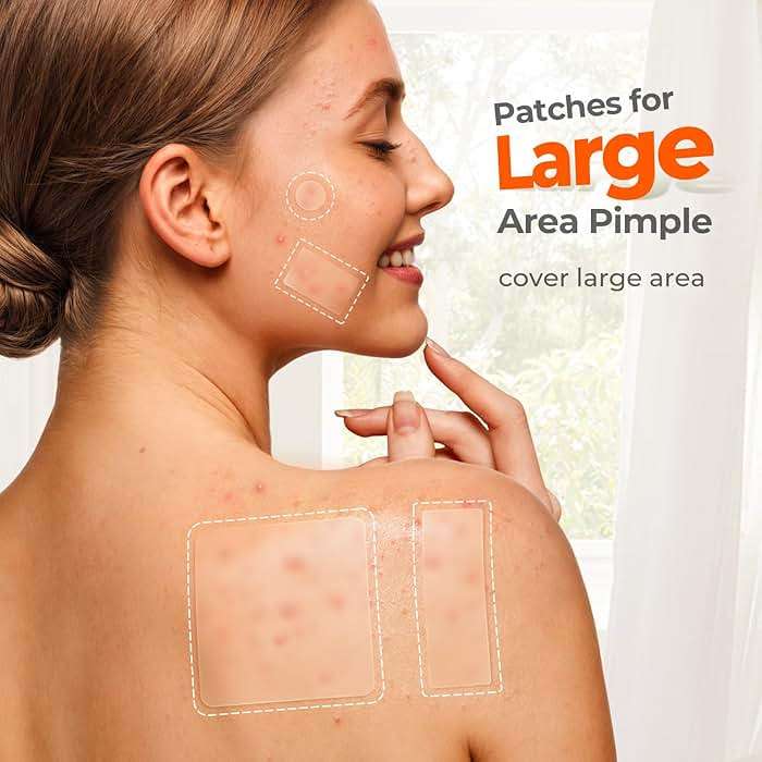 TKTK Large Pimple Patches for Face, 7 Sizes XL Acne Patches, Big Hydrocolloid Bandages for Body, Chin, Forehead, Chest, Back Zit Breakouts, Hydrocolloid Patch (Strip, Square, Dot 126 Count) - Image 3