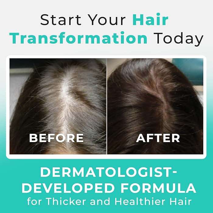 Hair Plus MD Hair Growth Supplement, 120 Capsules – Supports Hair Growth & Density – Dermatologist-Developed with Collagen & Vitamins – Gluten-Free, Toxin-Free, Non-GMO – 1 Month Supply - Image 5