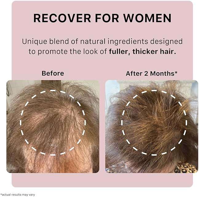 ACTIIV Recover Travel Duo For Women | Supports the Appearance of Fuller, Healthier-Looking Hair, Plant-Based, Color-Safe, Vegan, All Hair Types - Image 6