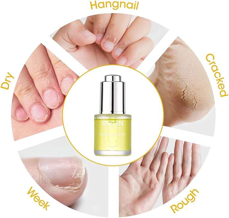 GELLEN Nail Growth Oil, Nail Cuticle Oil for Growth and Strength, Vitamin E Natural Keratin Cuticle Nails Treatment for Hydrating, Nourishing, Strengthening, Repairing, 0.68 Oz - Image 4
