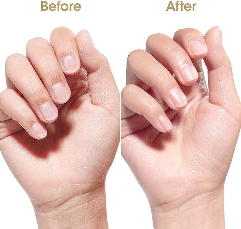 GELLEN Nail Growth Oil, Nail Cuticle Oil for Growth and Strength, Vitamin E Natural Keratin Cuticle Nails Treatment for Hydrating, Nourishing, Strengthening, Repairing, 0.68 Oz - Image 5