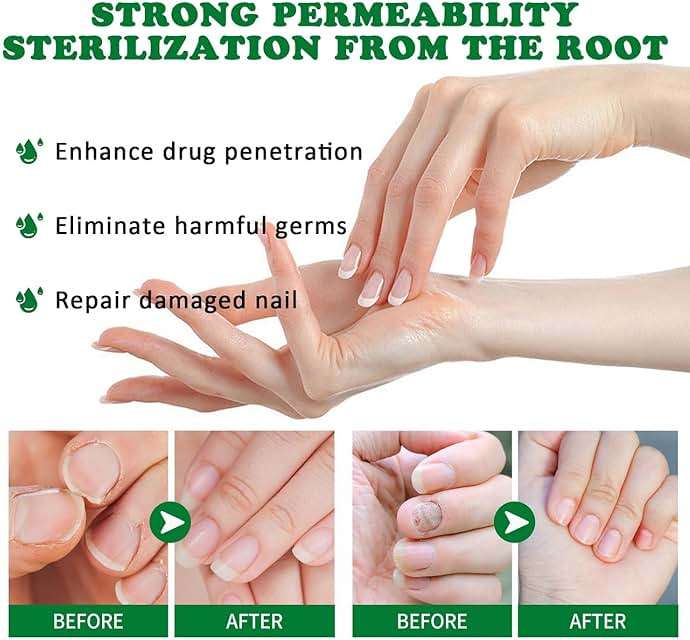 3Pcs Ginger Nail Treatment, 7days Nail Growth Serum Solution, Ginger Cuticle Care Oil for Nails Strengthener, Promote Nail Healthy Grow(30ml) - Image 4