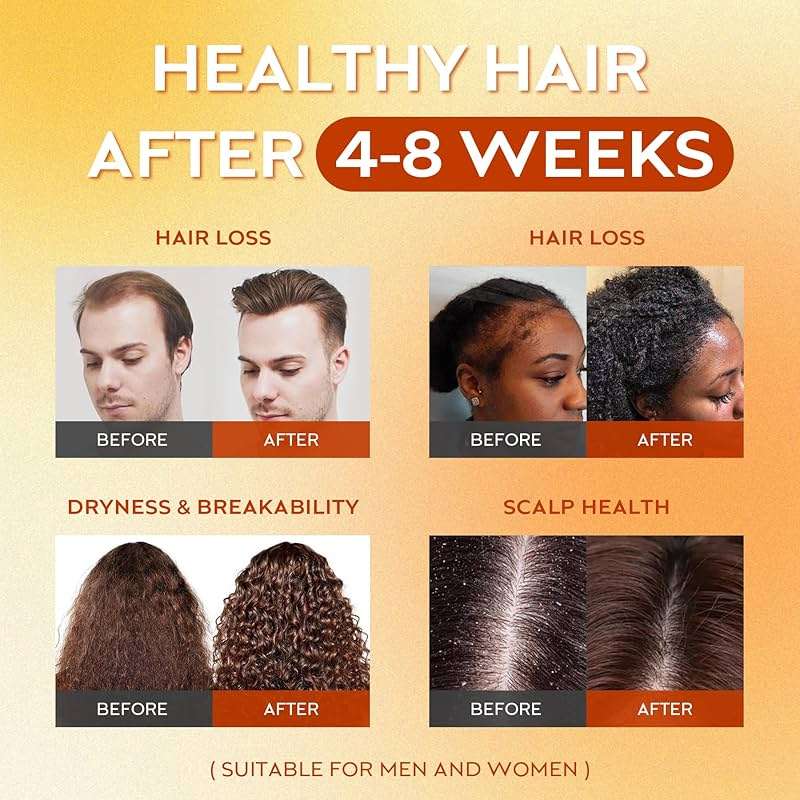 WEEMOTD 100% Raw Batana Oil for Hair, Unrefined Conditioning Hair & Scalp Oil from Honduras, Moisturizing Hair Mask for Dry Hair, Adds Shine & Softness for Men & Women, 2 fl oz - Image 4