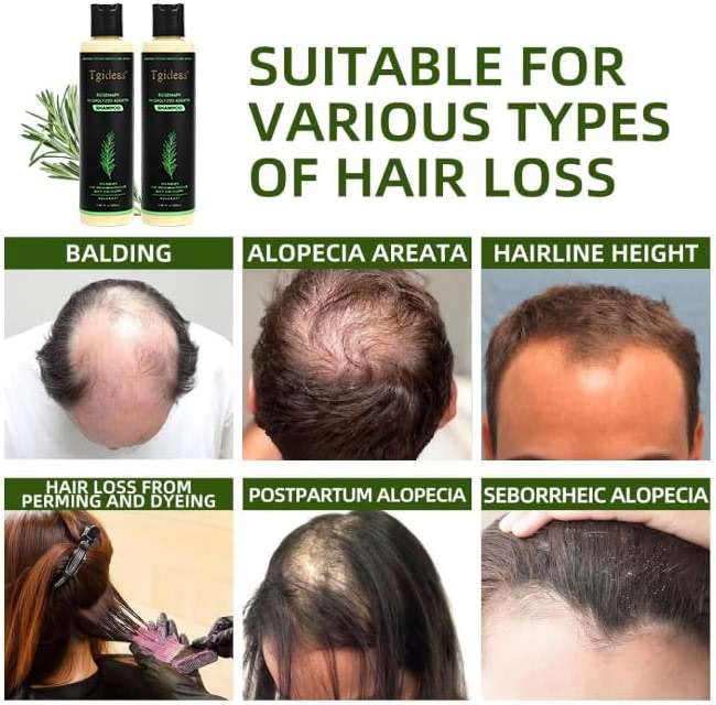 Organic Rosemary Hair Growth Shampoo for Women and Men-Natural Thickening & Strengthening Shampoo with Hydrolyzed Keratin for Thinning Hair & Hair Loss 7.4 fl.oz - 2 Packs - Image 4