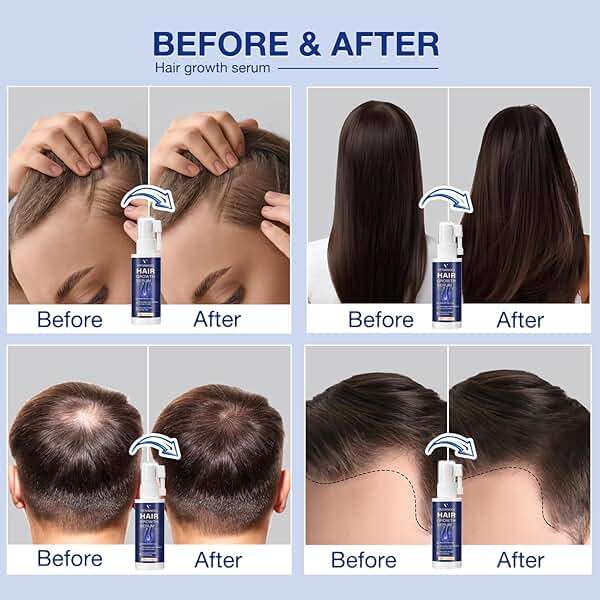 VENANOCI Hair Growth Serum Spray: with Rosemary, Biotin, Batana Oil & Rice Water – Natural Anti-Hair Loss Treatment for Thinning Hair – Promotes Thicker, Fuller Hair for Women & Men – All Hair Types - Image 2