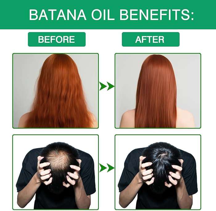 hawdoll Batana oil Hair Treatment Oil for Deep Nourishment and Care - Image 4